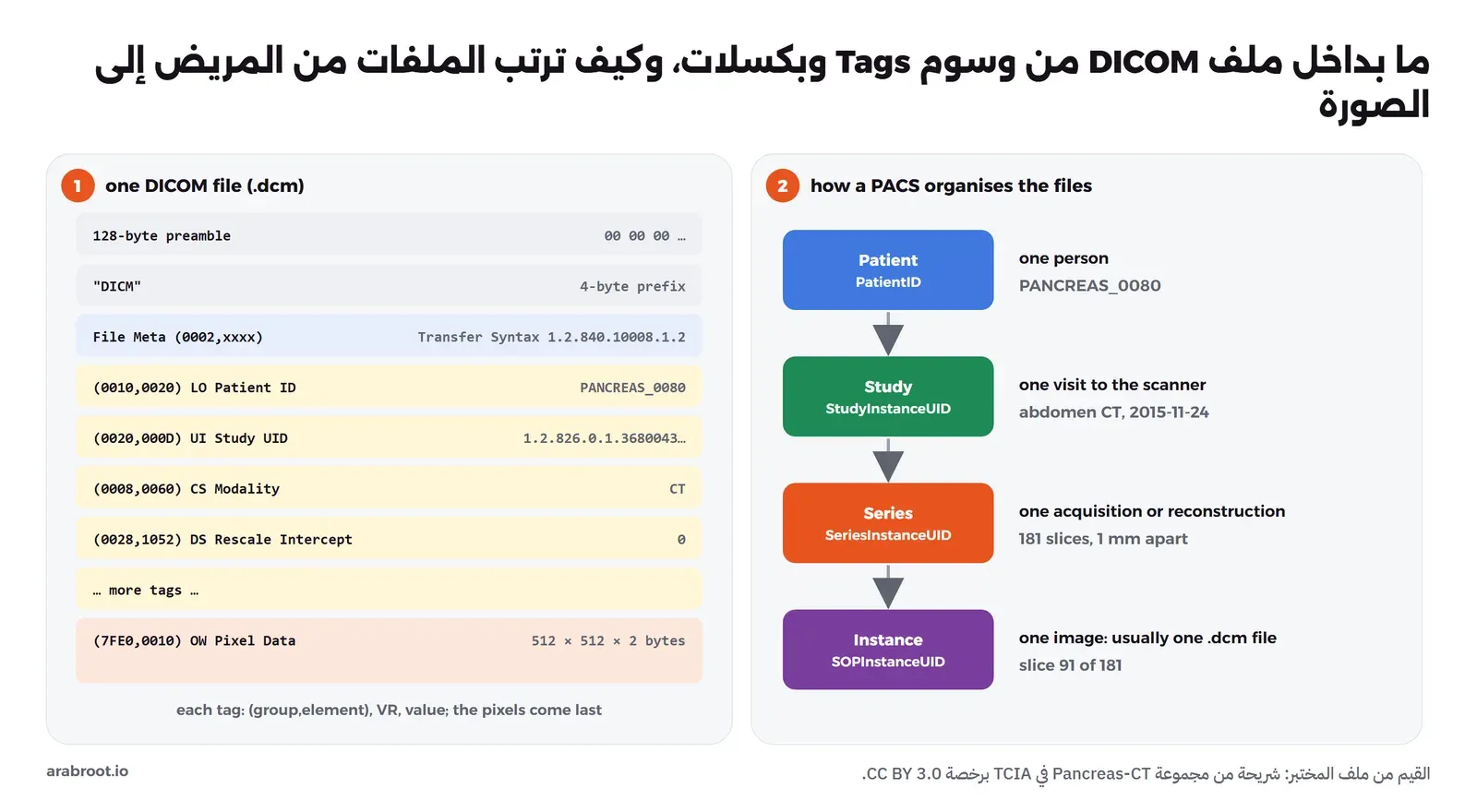 على اليسار ملف DICOM من الأعلى للأسفل: مقدمة 128 بايت، ثم DICM، ثم الوسوم الوصفية في المجموعة 0002 ومنها Transfer Syntax، ثم وسوم مثل Patient ID وStudy UID وModality وRescale Intercept، وفي الأسفل Pixel Data بحجم 512 في 512 في 2 بايت. وعلى اليمين الهرم: Patient بمعرف PatientID، ثم Study بمعرف StudyInstanceUID وهي زيارة واحدة للجهاز، ثم Series بمعرف SeriesInstanceUID وفيها 181 شريحة، ثم Instance بمعرف SOPInstanceUID وهي صورة واحدة في ملف واحد