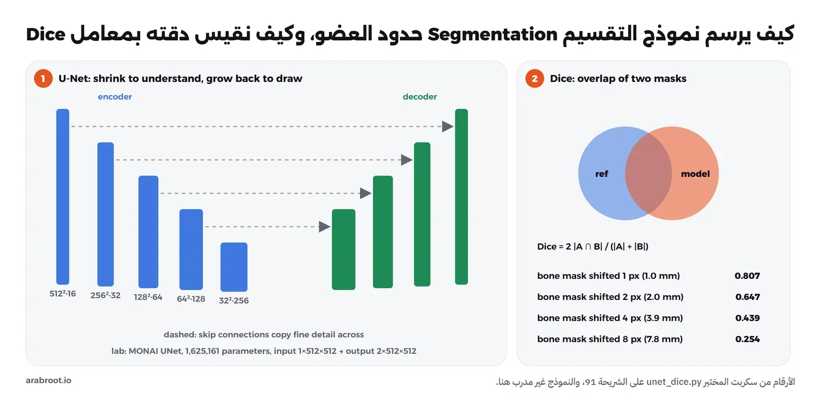 على اليسار شكل U-Net: خمسة مستويات تصغر فيها الصورة من 512 إلى 32 بكسل ويزيد عدد القنوات من 16 إلى 256 وهو المشفر Encoder، ثم أربعة مستويات تكبر فيها الصورة مرة أخرى وهو المفكك Decoder، وخطوط متقطعة بين المستويات المتقابلة تنقل التفاصيل الدقيقة، وتحتها أن نموذج MONAI في المختبر فيه 1,625,161 معاملاً ومدخله 1 في 512 في 512 ومخرجه 2 في 512 في 512. وعلى اليمين دائرتان متقاطعتان للقناع المرجعي وقناع النموذج ومعادلة Dice، وقيم Dice عند إزاحة قناع العظم بكسلاً 0.807 وبكسلين 0.647 وأربعة 0.439 وثمانية 0.254